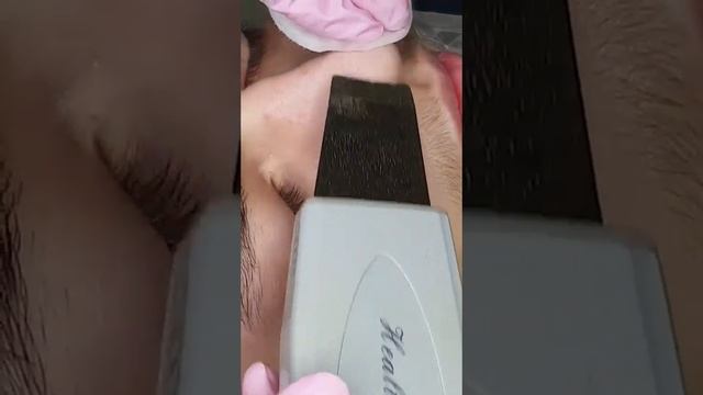 Чистка лица #косметология #пилинглица #cosmetology #косметологднепр #массажлица #косметологдніпро смотреть онлайн