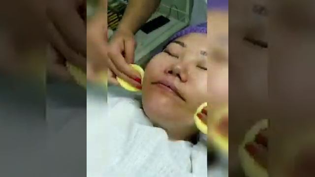 Беттеги дактарды кетируу Пилинг для лица 