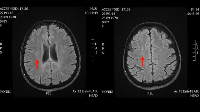 Синдром Сусака смотреть онлайн