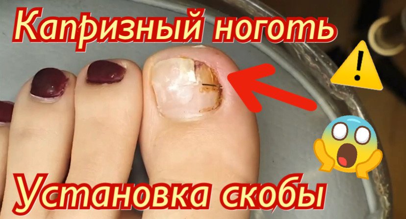 Капризный ноготь??⚠️???