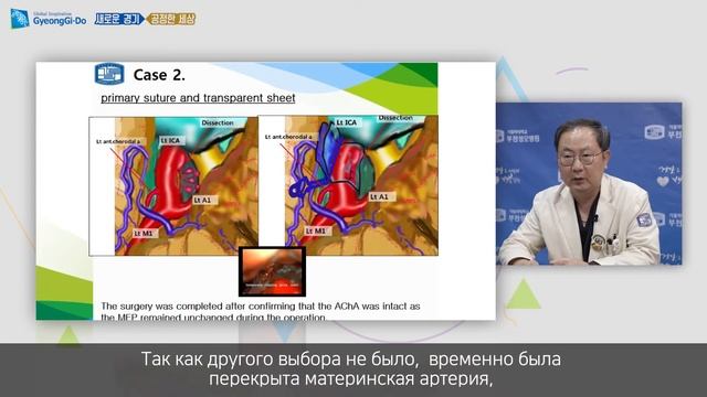 Лекция по аневризме головного мозга смотреть онлайн