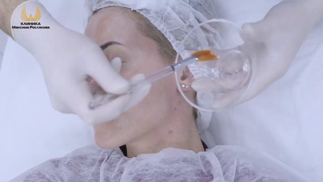 Миндальный пилинг смотреть онлайн