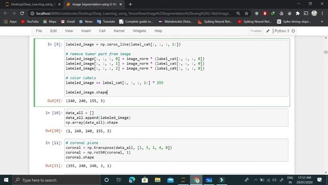 Brain Tumor detection based on MRI Image Segmentation using U-Net from Scratch in Tensorflow смотреть онлайн