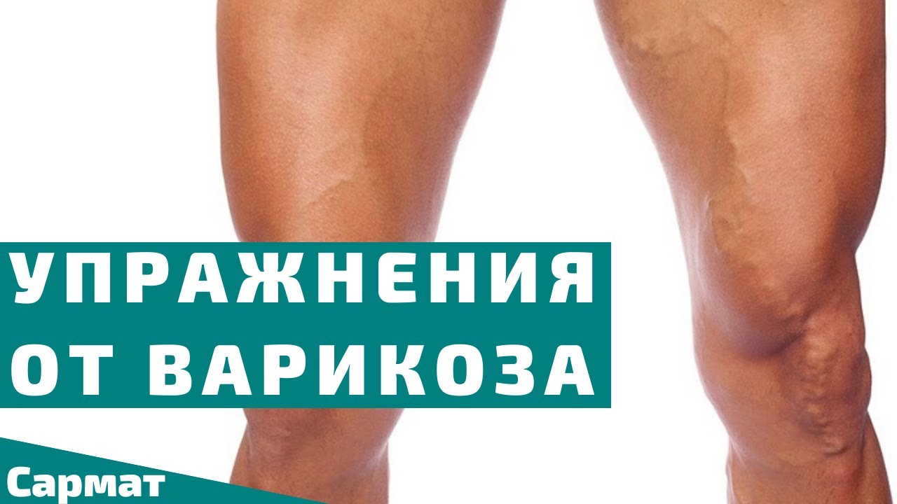 Три упражнения от варикоза. Гимнастика против варикозного расширения вен смотреть онлайн