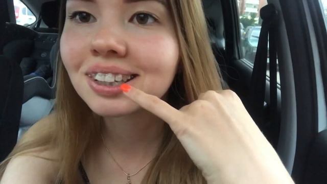 Поставили нижние брекеты 😱 смотреть онлайн