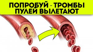 Моментально чистят сосуды от тромбов! Самые лютые продукты от инфаркта, инсульта…