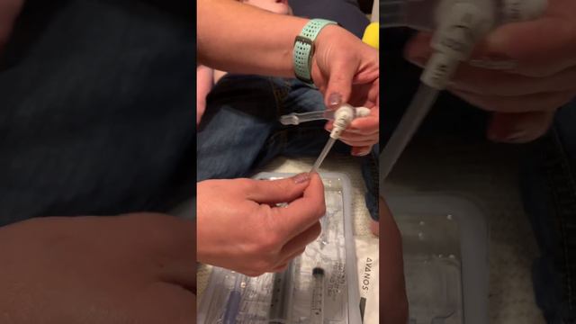 MIC-KEY Feeding Tube Button Change. Feeding Tube Awareness ❤️ смотреть онлайн