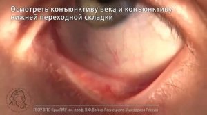 Удаление инородного тела из полости конъюнктивы