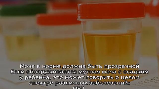 Почему у ребенка мутная моча, означает ли осадок наличие инфекции смотреть онлайн