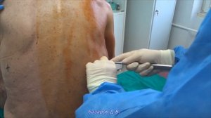 Step by step - дренирование плевральной полости (РНЦХ)