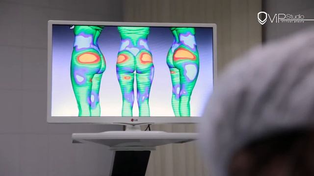 Custom Implants for plastic surgery. Vip Studio, Moscow. смотреть онлайн
