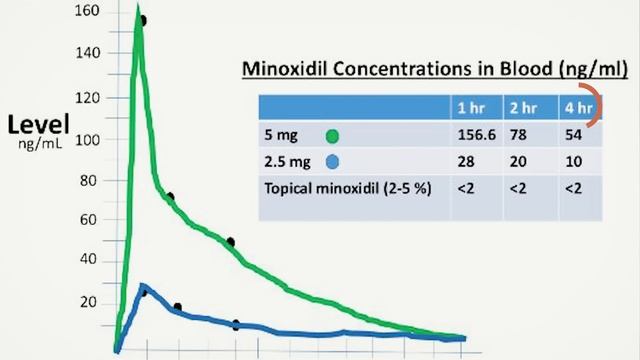 Oral Minoxidil Month 3 Update, ECG, Hair Progress, Side Effects... смотреть онлайн