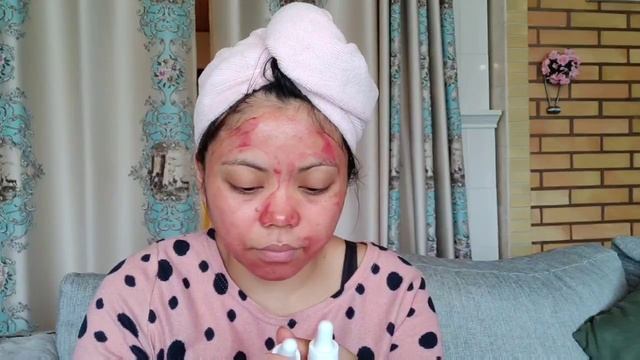 The Ordinary Peeling Solution review| Buffet|Hyaluronic Acid смотреть онлайн