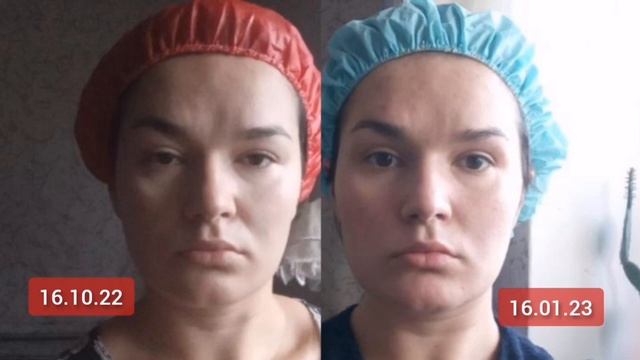 Техника 5 предков. Результат массажа лица. Выводы делайте сами) Массаж на канале "Ладушка" смотреть онлайн