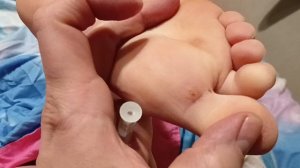 Шипица. Как вылечить???