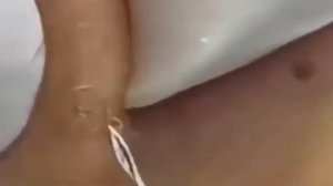 #15 Удаление больших кистозных угрей|Удаление черных точек|Удаление белых точек|Выступление прыщей!