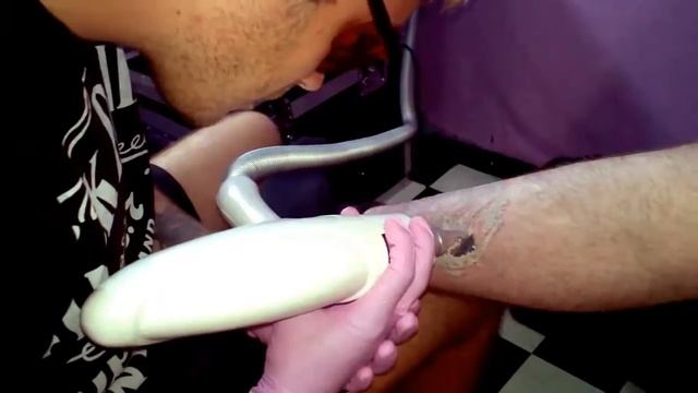 Delete Tattoo-Мастерская дел чернильных смотреть онлайн