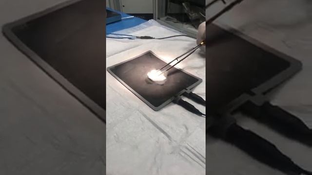 Как прикурить сигарету от электрокоагулятора смотреть онлайн