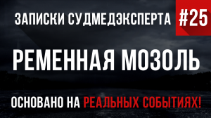 Записки Судмедэксперта #25 «Ременная Мозоль»
