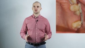 ИМПЛАНТАТЫ + БРЕКЕТЫ | 7 советов об имплантации. Взгляд ортодонта.