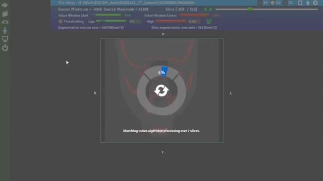Soteria DcmRecons Demo 3 (Full tutorial) смотреть онлайн