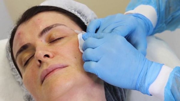 Процедура биоревитализации препаратом REPART PG.