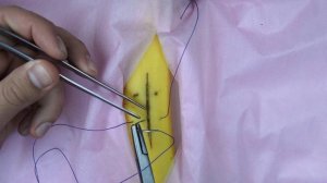 шов мак-миллана - донати или вертикальный п-образный шов (техника; как наложить)