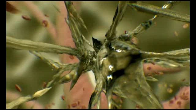 Алкоголь и мозг