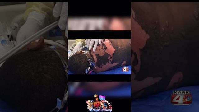 Parents explain their side when 8 y/o Jayceon burned at friends home… #msniquerevamp #icmtsu смотреть онлайн