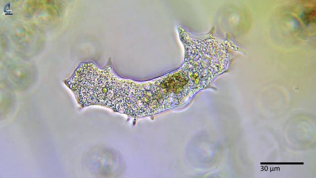 Амёба Хаос (Chaos). Amoeba Chaos.