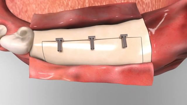 Split Surgery Master 3 смотреть онлайн