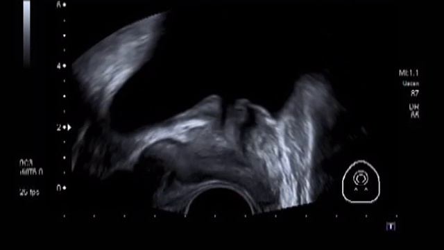 Осень Простатит Медпрайм Запорожье Алекс Скорость 16 10 2013