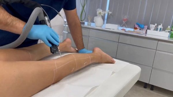 Épilation dernière génération Deka Replay et Moveo sans douleur au Centre Podium Montbonnot