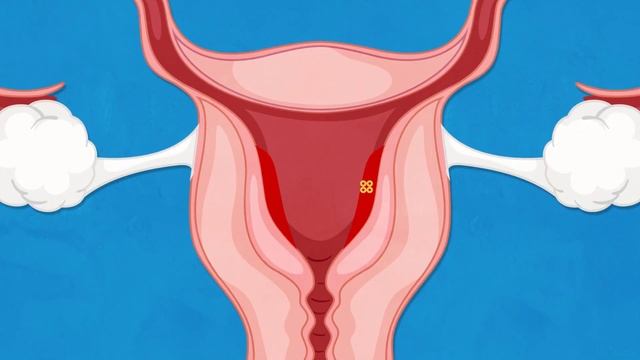 How does mifepristone work? смотреть онлайн