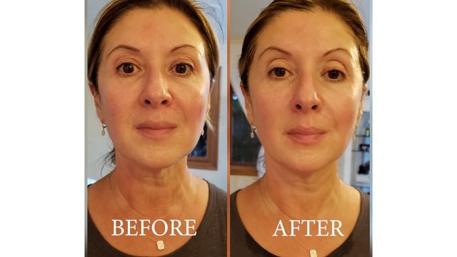 FACELIFT IN A BOTTLE? | INSTANT RESULTS WITH BEFORE AND AFTER | AGE FREEZE DOUBLE DARE FACE MASK смотреть онлайн