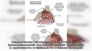 Причины появления крови из носа при сморкании