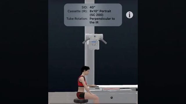 RAD X-ray Finger, thumb, Hand VR voiceover смотреть онлайн