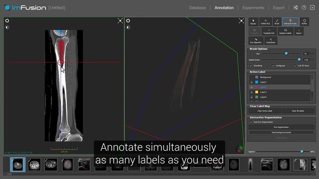 ImFusion Labels - Optimize your AI Workflow with Medical Images смотреть онлайн
