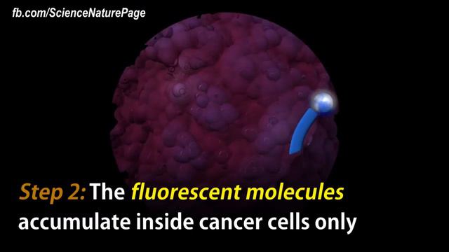 Researchers make tumors glow to assist surgeons in removing them смотреть онлайн