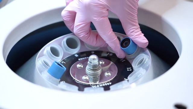 ТРИХОЛОГИЯ в ЦК«FACE CONCEPT» смотреть онлайн