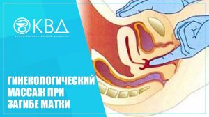 ✅ 1474  Гинекологический массаж при загибе матки