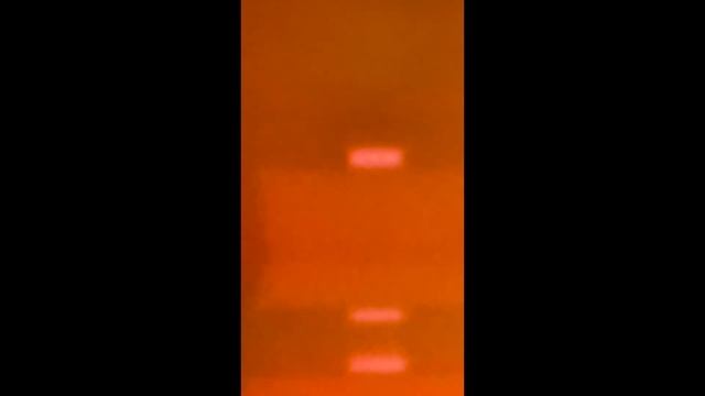 How To Remove The Antenna on a Focus ST смотреть онлайн