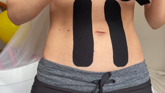 Тейпирование при диастазе. Убираем диастаз.