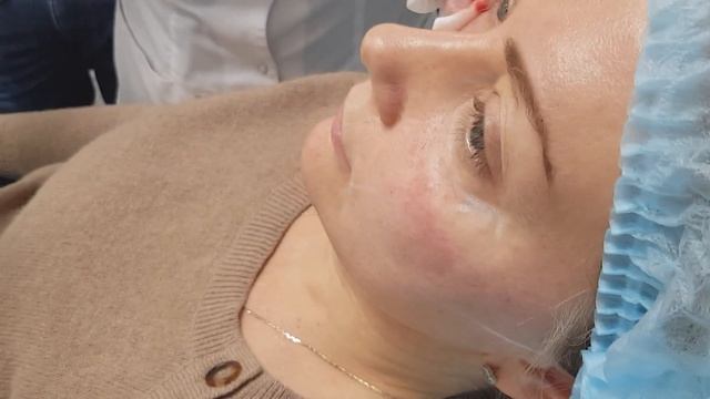 Обучение косметологов , мастер-класс проводит Врач дерматолог - косметолог Хуснутдинова Н.В. смотреть онлайн