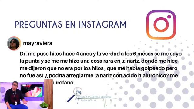 PELIGRO DE LOS HILOS TENSORES EN LA NARIZ / 4ta temporada смотреть онлайн