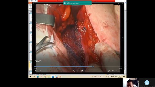 ГРЫЖИ ЖИВОТА - УКРЕПЛЯЕМ самой КОЖЕЙ ....Наиболее надёжно! смотреть онлайн