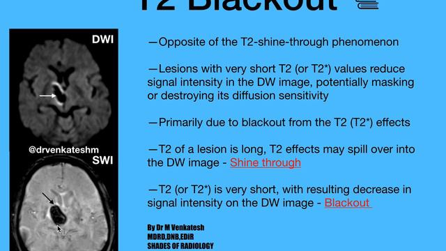 T2 blackout Phenomenon смотреть онлайн