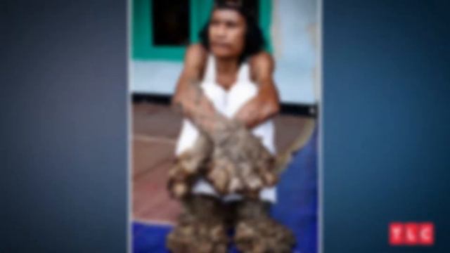 10 Moments on My Feet Are Killing Me That Will Make You SICK! смотреть онлайн