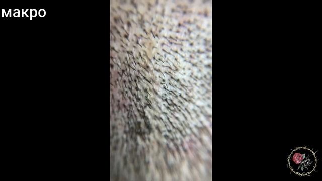 Маскировка шрама на голове. Трихопигментация, татуировка волос в Москве. смотреть онлайн