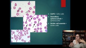 7. Кроветворение Лекция по гистологии